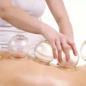 Cupping Therapy Cupping Therapy